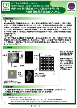 開曲線フーリエ記述子を用いた X線画像処理方法及びシステム