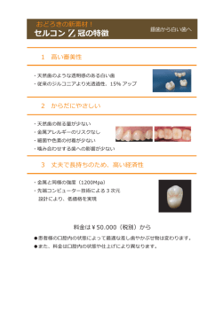 セルコン Z冠の特徴