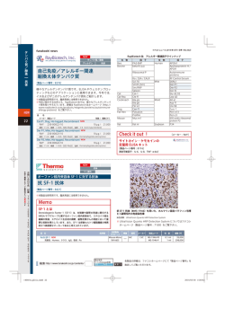 &minus; 自己免疫／アレルギー関連 組換え体タンパク質 抗 SF-1 抗体