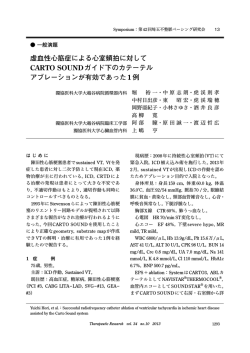虚血性心筋症による心室頻拍に対して CARTO SOUND
