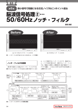 脳波信号処理②&hellip; 50/60Hzノッチ・フィルタ