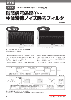 脳波信号処理①&hellip; 生体特有ノイズ除去フィルタ