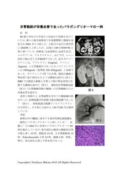 Ⅲパラガングリオーマ （PDF）