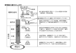 歯周病の進行のしかた（PDF：59.6KB）