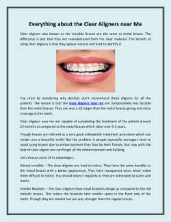 Everything about the Clear Aligners near Me