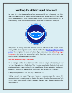 How long does it take to put braces on