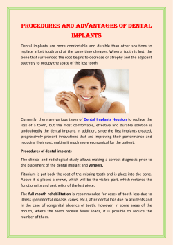 Procedures and Advantages of dental implants