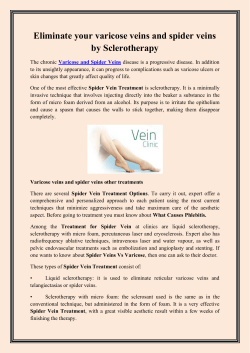 Eliminate your varicose veins and spider veins by Sclerotherapy