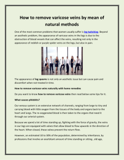 How to remove varicose veins by mean of natural methods
