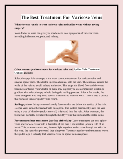 The Best Treatment For Varicose Veins