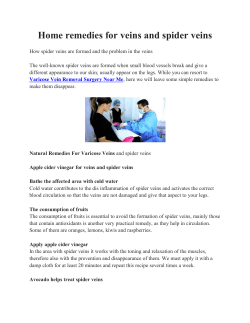 Home remedies for veins and spider veins