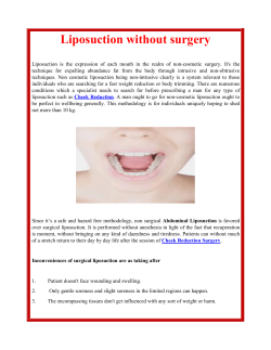 Liposuction without surgery