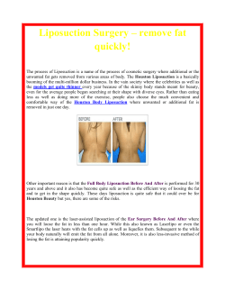 Liposuction Surgery &ndash; remove fat quickly!