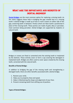 What are The Importance and Benefits of Dental Bridges