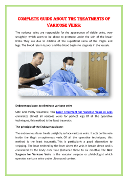 Complete guide about the treatments of Varicose Veins