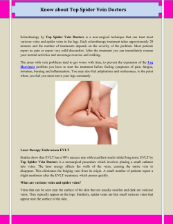Know about Top Spider Vein Doctors