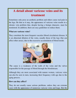 A detail about varicose veins and its treatment