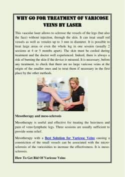 Why go for Treatment of varicose veins by laser