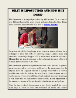 What is liposuction and how is it done