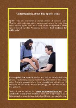 Understanding About The Spider Veins