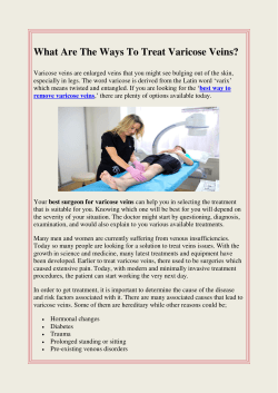 What Are The Ways To Treat Varicose Veins