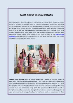 Facts About Dental Crowns
