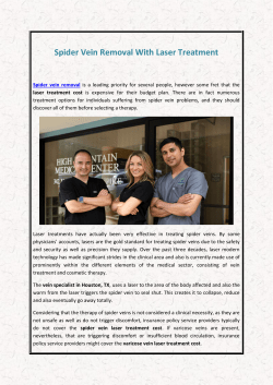 Spider Vein Removal With Laser Treatment