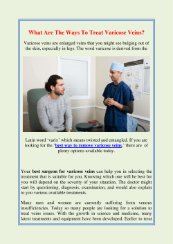 Know About Many Ways To Treat Varicose Veins