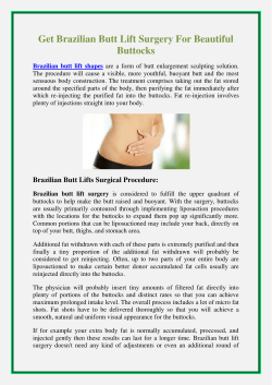 Get Brazilian Butt Lift Surgery For Beautiful