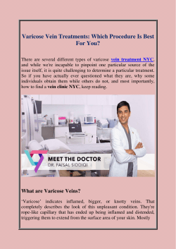 Varicose Vein Treatments Which Procedure Is Best For You