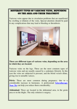 Different types of varicose veins, depending on the area and their treatment