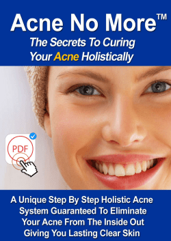 Acne No More PDF EBook Mike Walden Download Valuable Report